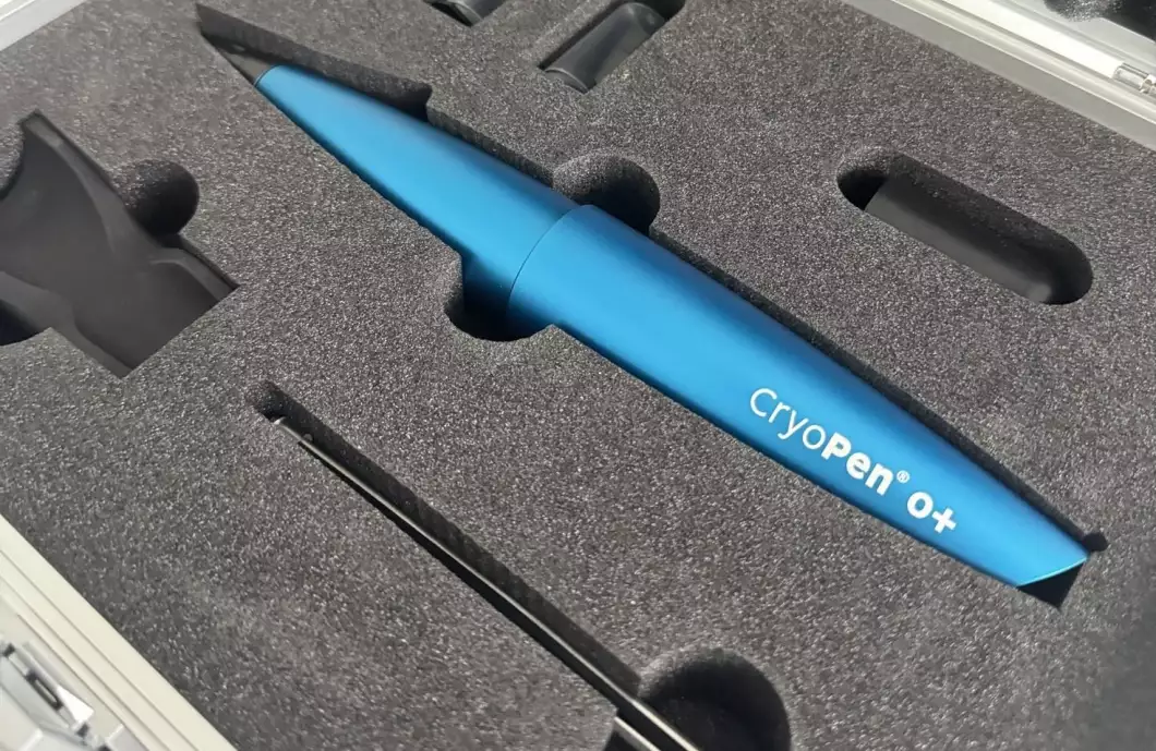 Nemocnice zavádí kryochirurgickou metodu CryoPen